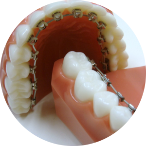 orthodontic_dentistry_a2